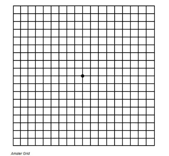 Amsler Grid
